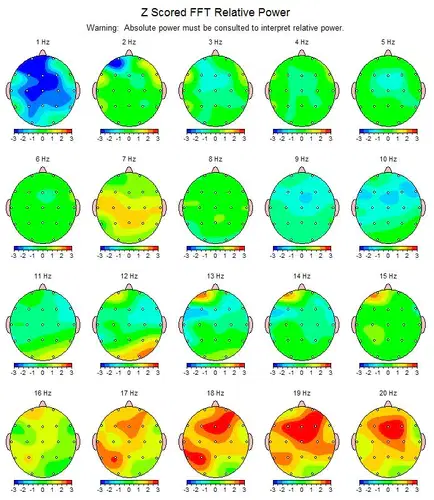 Can the Mind Heal Parkinson's?